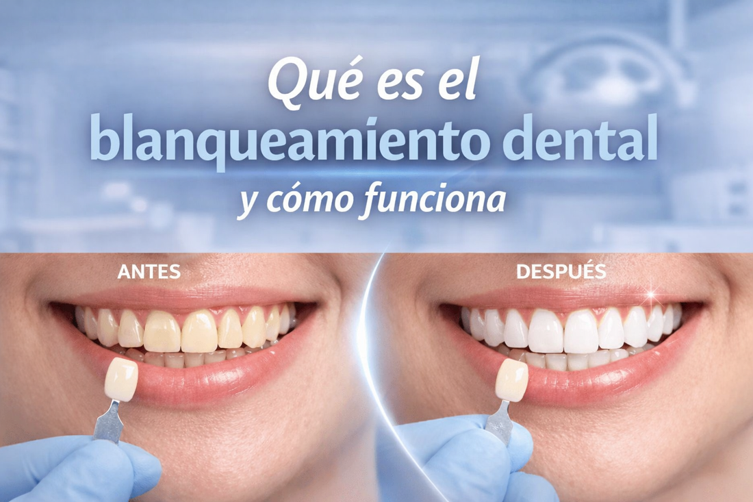 ¿Qué es el blanqueamiento dental y cómo funciona?