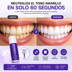 V34Glow™ — Blanqueador Dental Sin Peróxidos